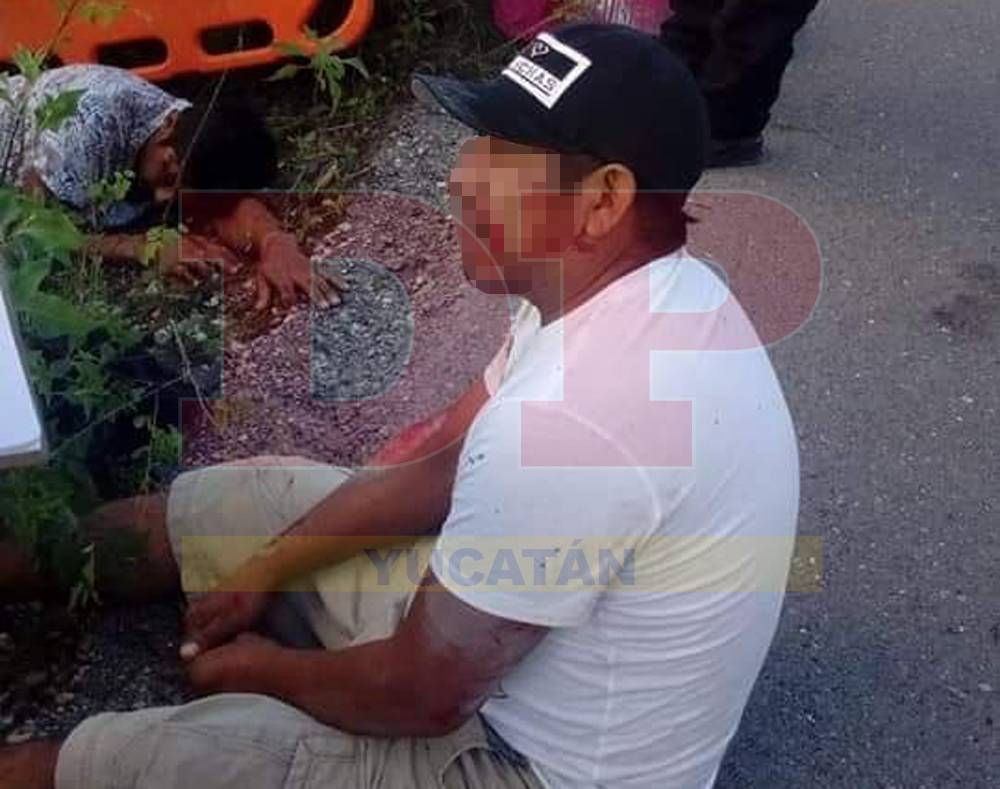 Dejaron la cara en el pavimento de la carretera Motul-Telchac