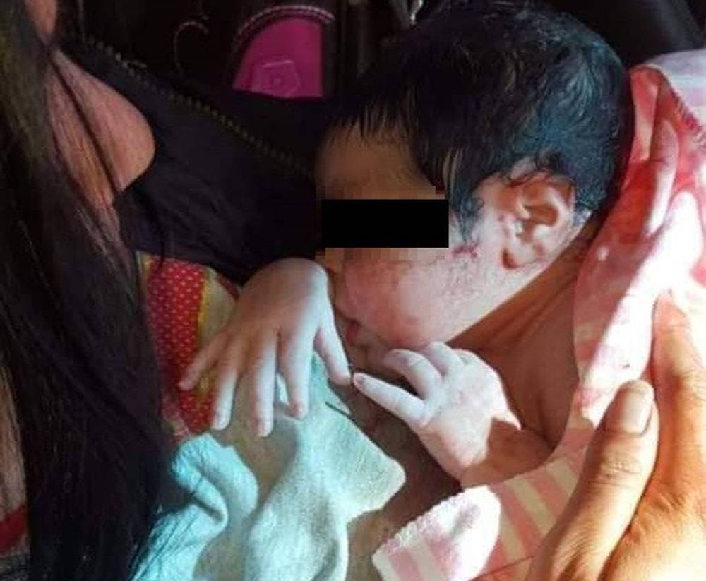 Centro de Salud usa garrafón como casco de oxígeno para una bebé