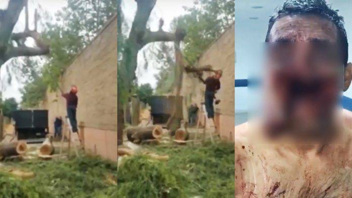 Árbol le arranca la cara tras intentar podarlo (Video fuerte)