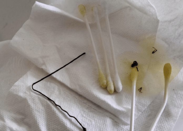 Dolor de cabeza y dolor dentro del oído