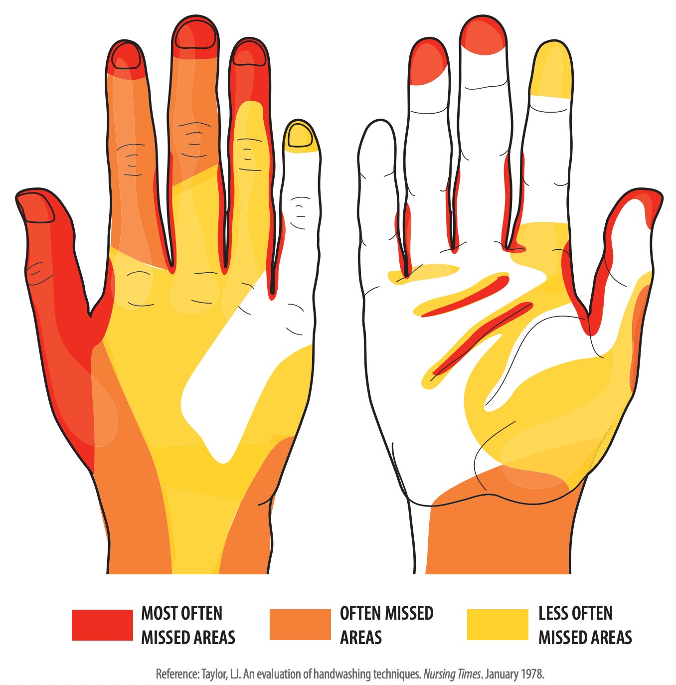 Gráfica en donde se muestra en rojo las zonas de la mano que se suelen descuidar más durante el lavado, en naranja las partes que se descuidan un poco menos y en amarillo lo que se suele limpiar mejor