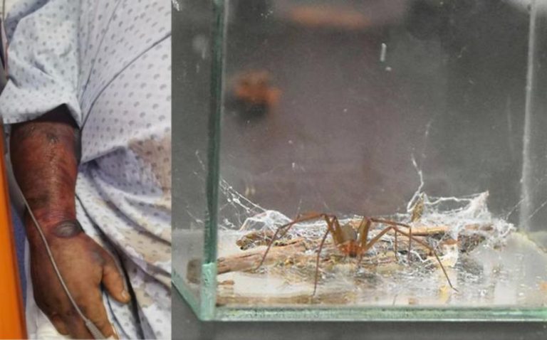 Muere en menos de 24 horas tras picadura de araña ...